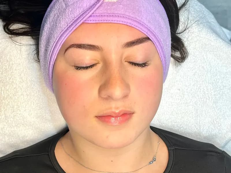 Dermaplaning Facial