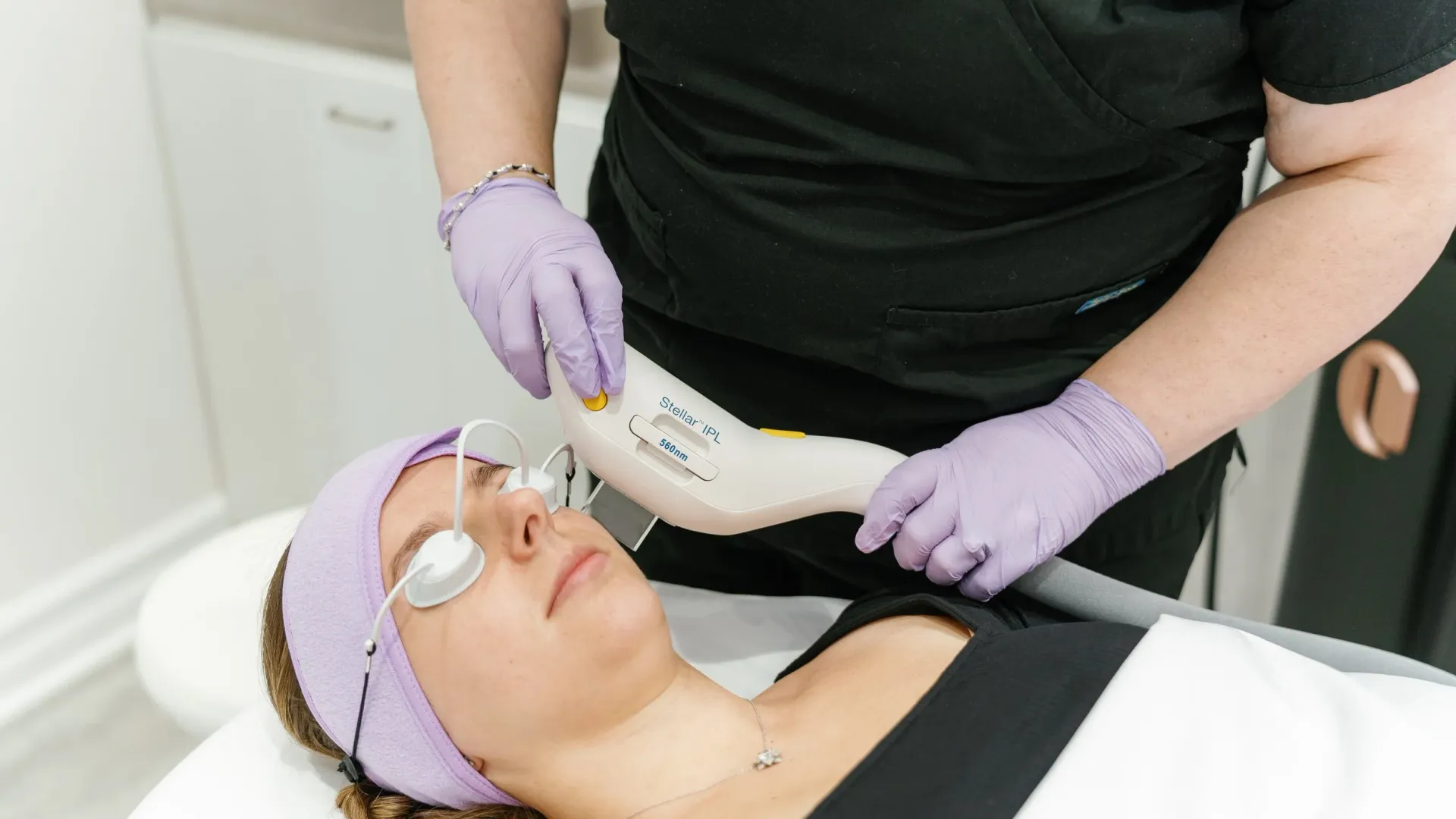 IPL Photofacial for Sun Spots, Redness, and Uneven Tone