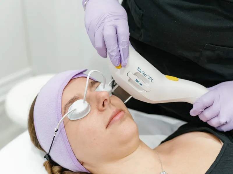SmoothGlo Treatment