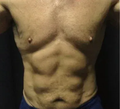 After treatment