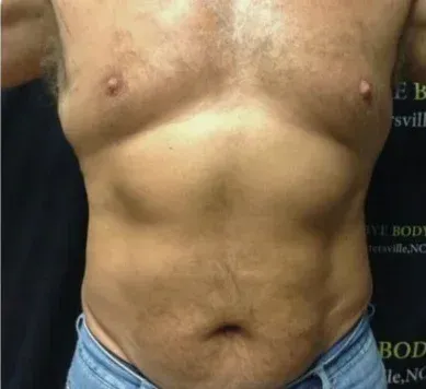 Before treatment