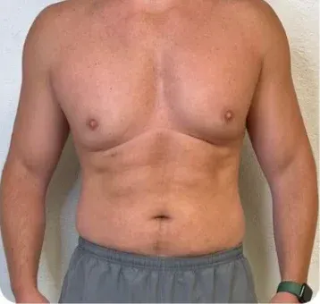 After treatment