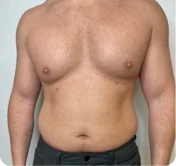 Before treatment